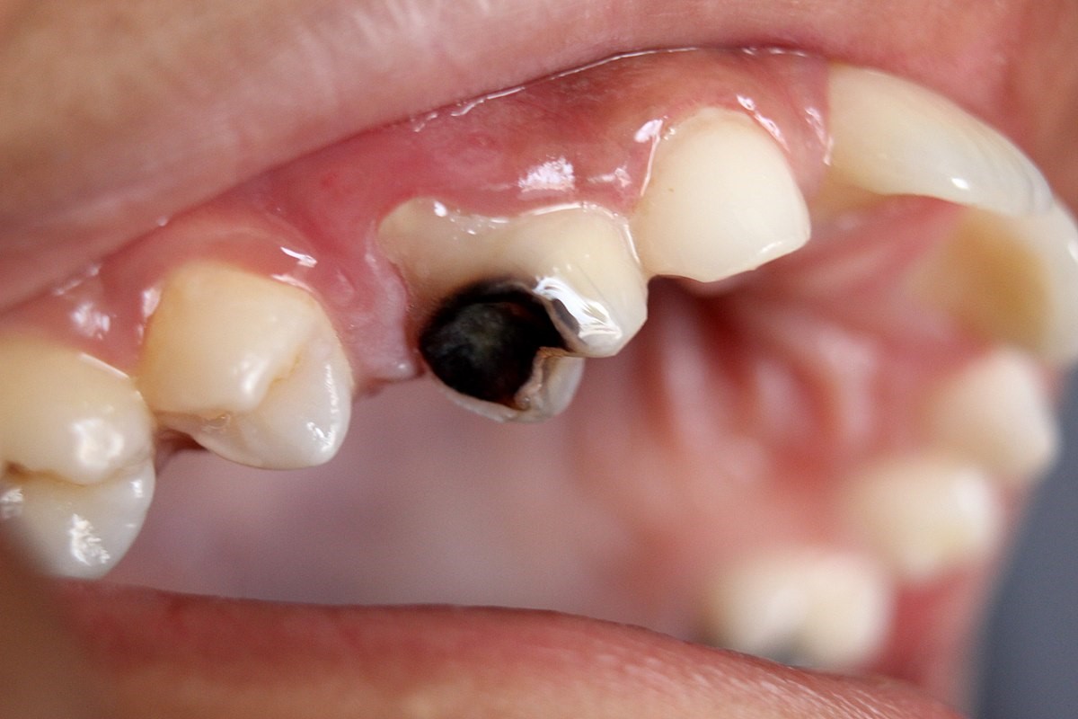 مشکلات شایع دهان و دندان در سالمندان ظاهر و ساختار